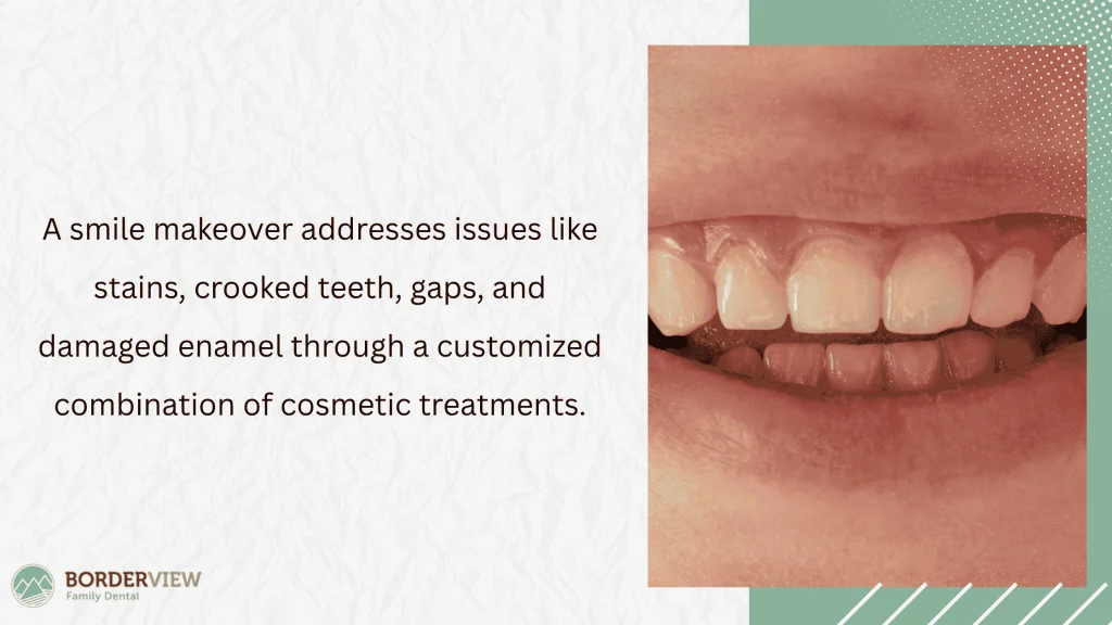 Common Smile Concerns Addressed
