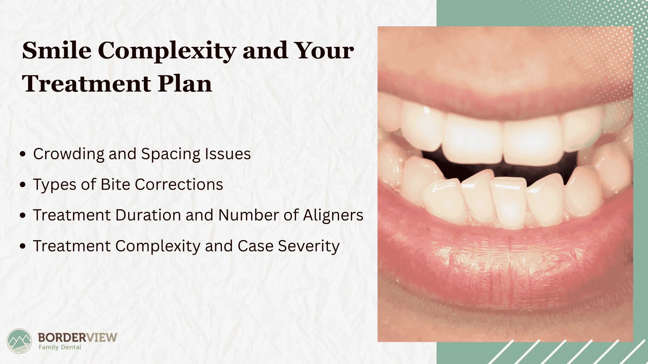 Complexity of Your Smile and Treatment Plan