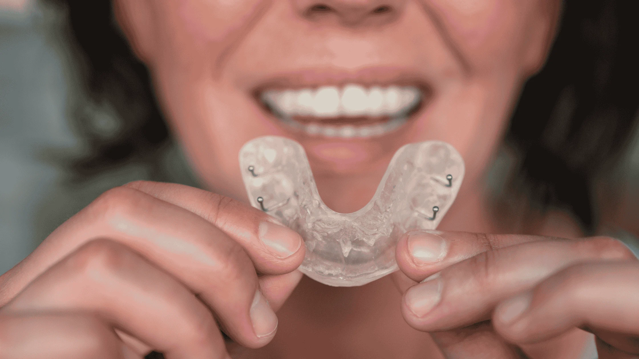 Protecting Implants From Teeth Grinding and Bruxism