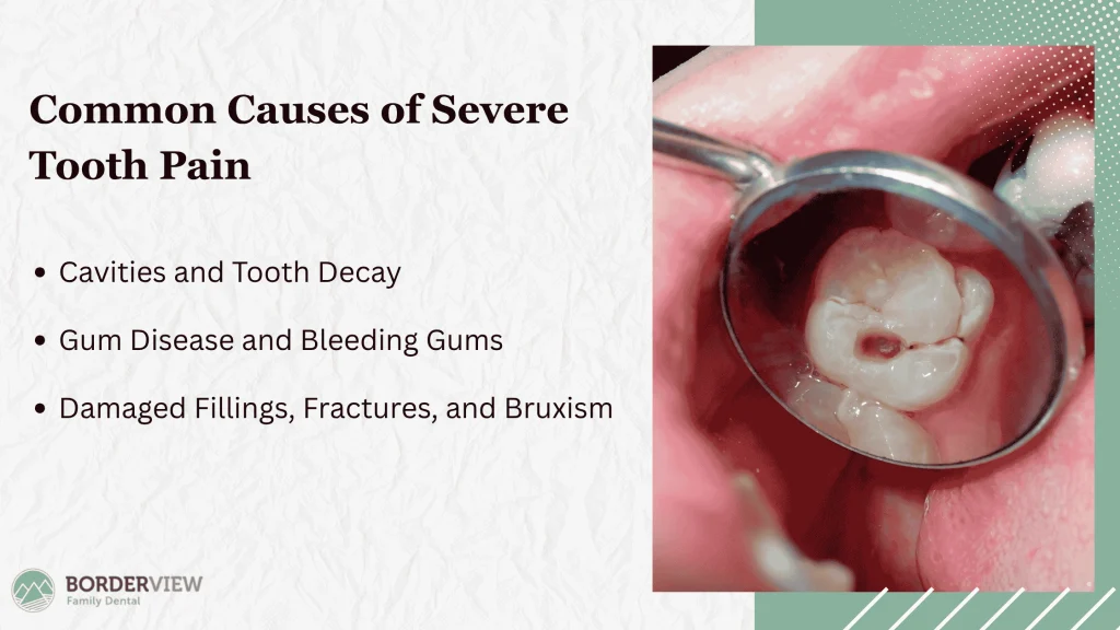 Underlying Causes Behind Severe Toothaches