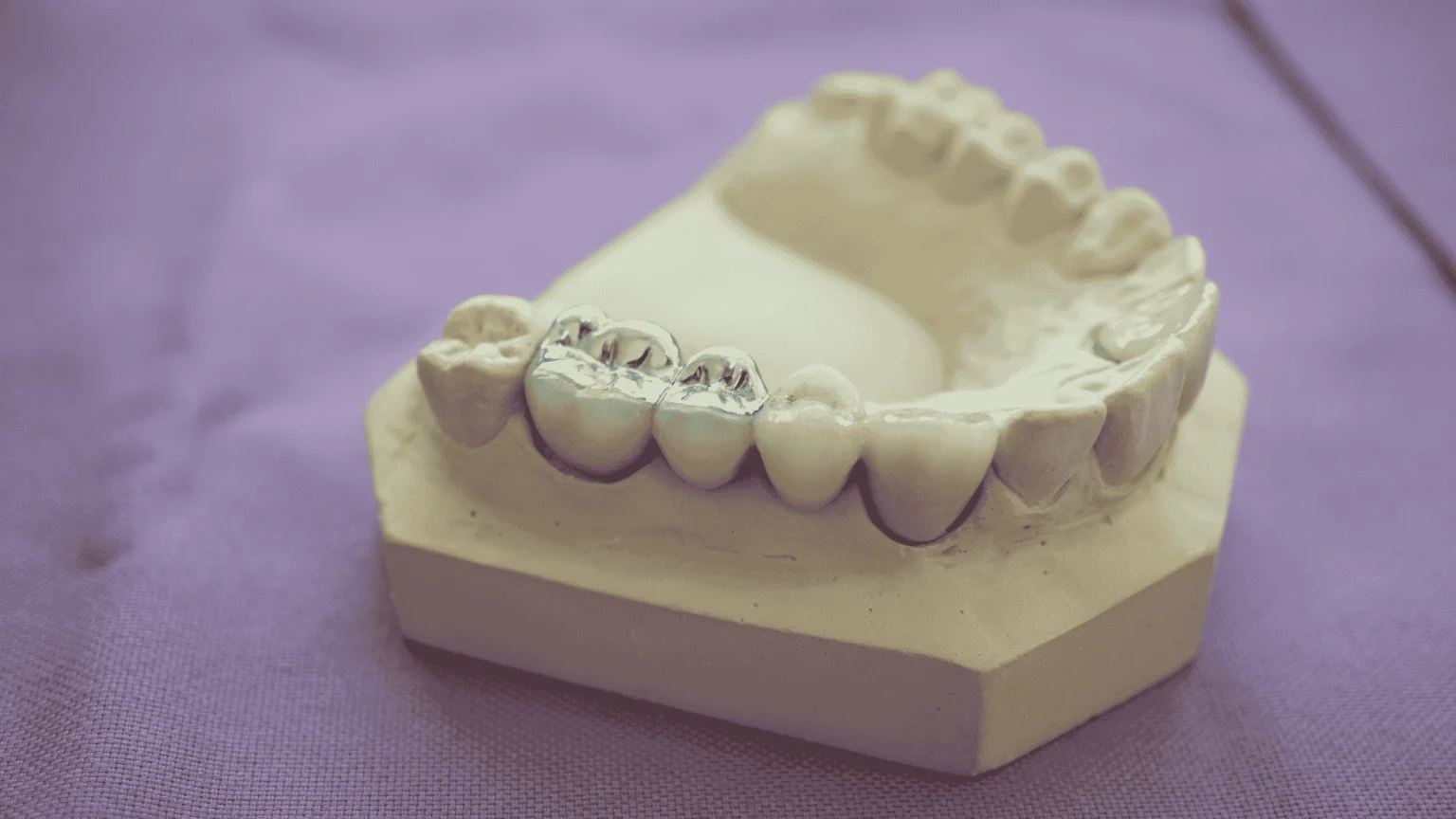When a Dental Crown Is Better Than a Filling: Key Guidelines Explained