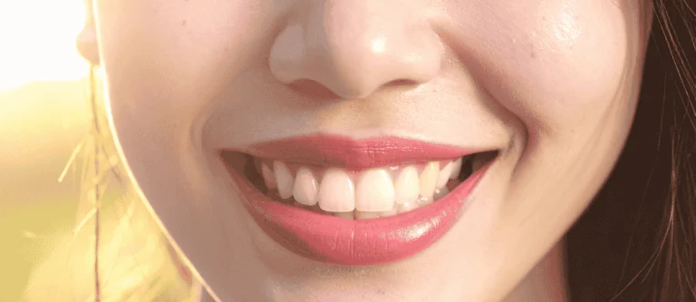 how long does a smile makeover take