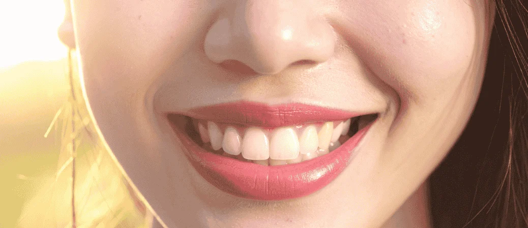 How Long Does a Smile Makeover Take? A Realistic Timeline