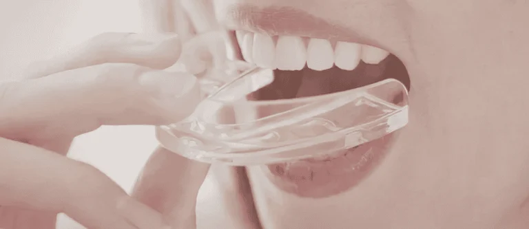 night teeth grinding treatment