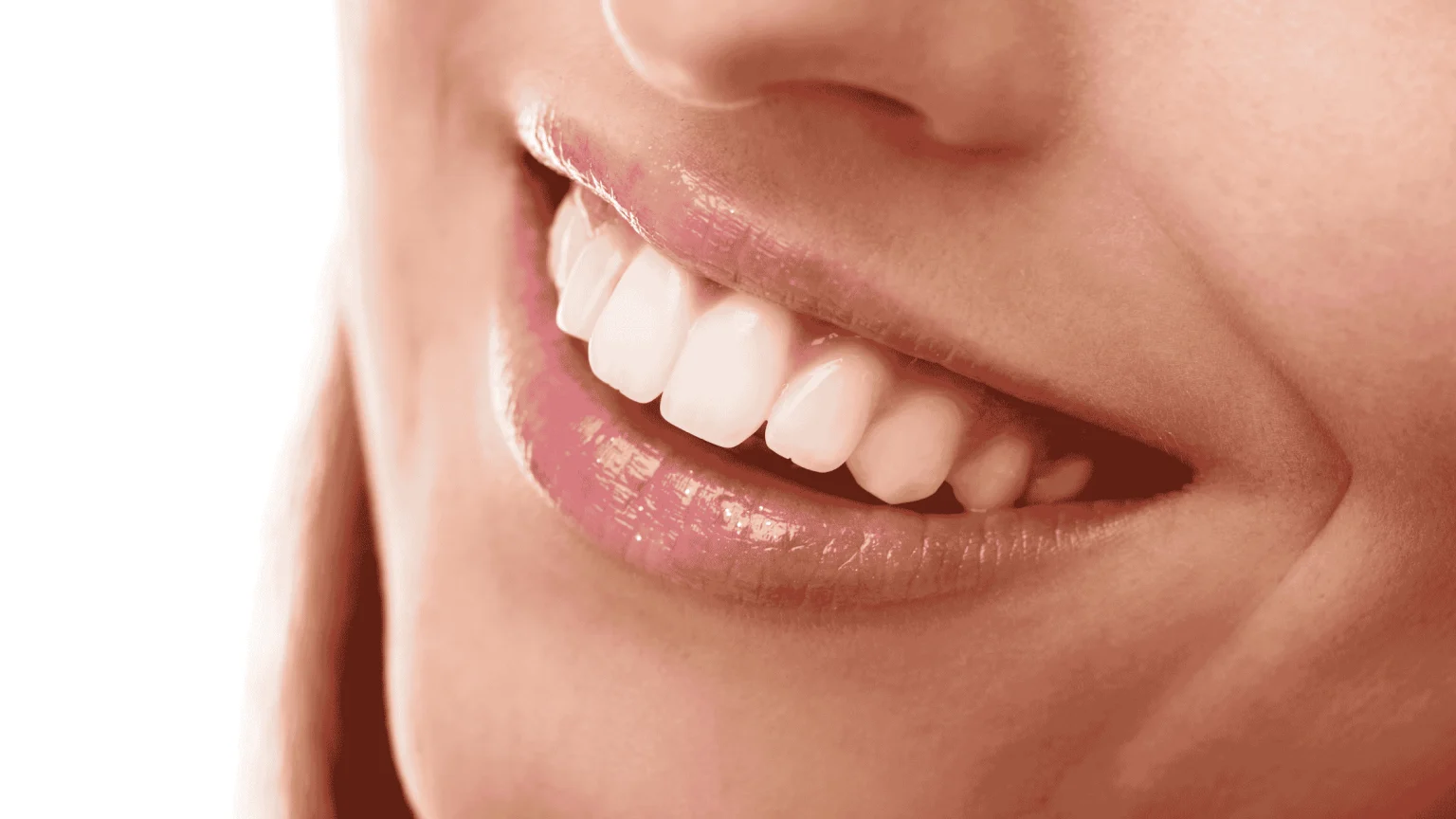 Smile Makeover Planning: How to Combine Whitening, Crowns & Aligners