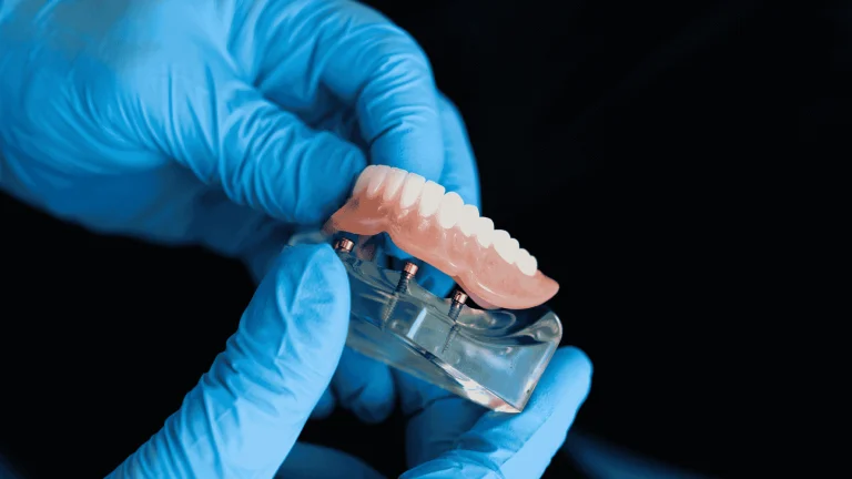 snap-in dentures vs traditional dentures